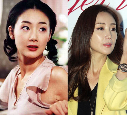 Nữ diễn viên "Bản tình ca mùa đông" Choi Ji Woo cũng không tránh khỏi thời kỳ xuống sắc. Cô không còn giữ phong độ đỉnh cao nhan sắc như thời mới nổi. Thay vào đó, gương mặt lộ dấu hiệu tuổi tác và cứng đơ. Choi Ji Woo để lộ nhiều nhược điểm trên gương mặt khi đã bước vào độ tuổi ngoài 40. Tháng 3 năm ngoái, nữ diễn viên 43 tuổi tổ chức hôn lễ tại Seoul, Hàn Quốc cùng ông xã kém cả chục tuổi.