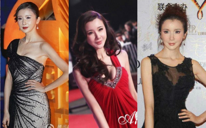 Tuy nhiên, hậu quả do thẩm mỹ đẩy người đẹp này vào con đường xuống sắc. Gương mặt Tôn Phi Phi trở nên cứng đờ, thiếu tự nhiên. May mắn bù lại cho nữ diễn viên là cuộc sống hôn nhân bên ông xã là doanh nhân, hiện làm lãnh đạo cấp cao của một tập đoàn thế giới.