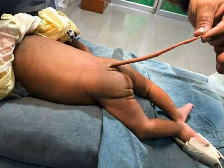 Thuc hu be so sinh moc duoi dai mien man khien cu dan mang xon xao-Hinh-2