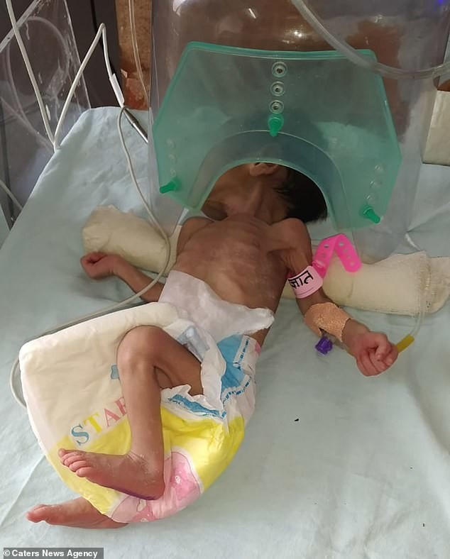 Bi chon sau duoi dat, be gai so sinh gay ngo ngang khi con song