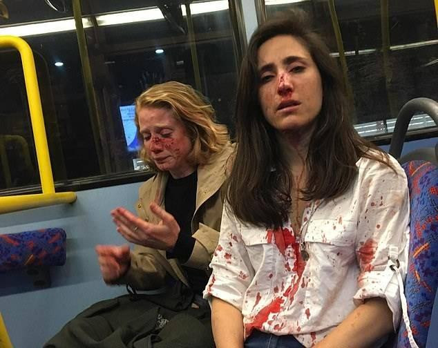 Cap dong tinh nu bi nhom dan ong hanh hung vi ly do soc