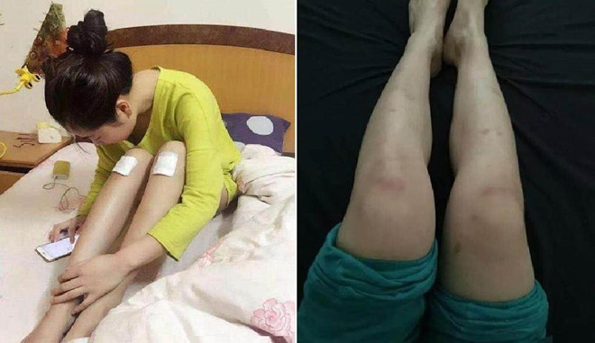 Một nữ diễn viên quần chúng cho biết cô từng quỳ hơn 20 tiếng trong một bộ phim cổ trang ở phim trường Hoành Điếm (Chiết Giang). Và mức thù lao cô nhận được cho cảnh quay này là 55 USD. Nhiều hôm, cô thậm chí còn chấp nhận ngồi xổm hơn 10 tiếng để làm "tiền cảnh" cho các bộ phim. "Tôi thường xuyên nhận đóng các vai tỳ nữ, cung nữ trong các phim cổ trang. Những vai này phải quỳ nhiều tiếng đồng hồ trên mặt đất. Vì vậy, tôi thường về nhà với đôi chân thâm tím và chi chít các vết bầm. Từ ngày làm công việc này, tôi chẳng còn dám mặc váy ngắn", một nữ diễn viên vừa chia sẻ vừa cho phóng viên xem các vết thương trên chân của mình.