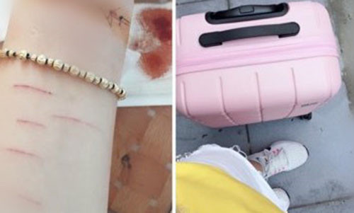 Co gai Sai Gon dung dao lam rach tay vi bi ban trai phan boi