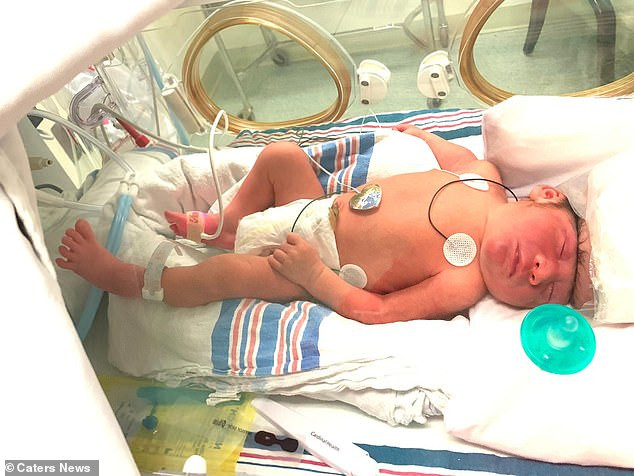 Benh la: Khong co vo nao, cau be song sot nhu mot ki tich