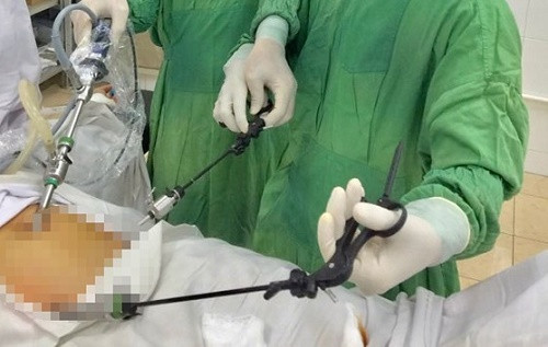 An lau qua nhanh, nu benh nhan bi xuong ca dam thung ruot gia