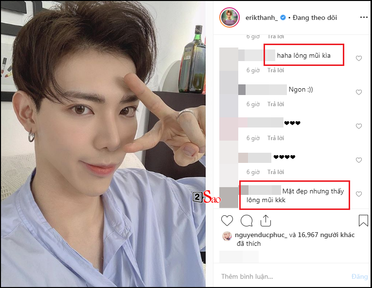 Erik bi fan to diem bat thuong tren khuon mat sau on ao tham my-Hinh-2