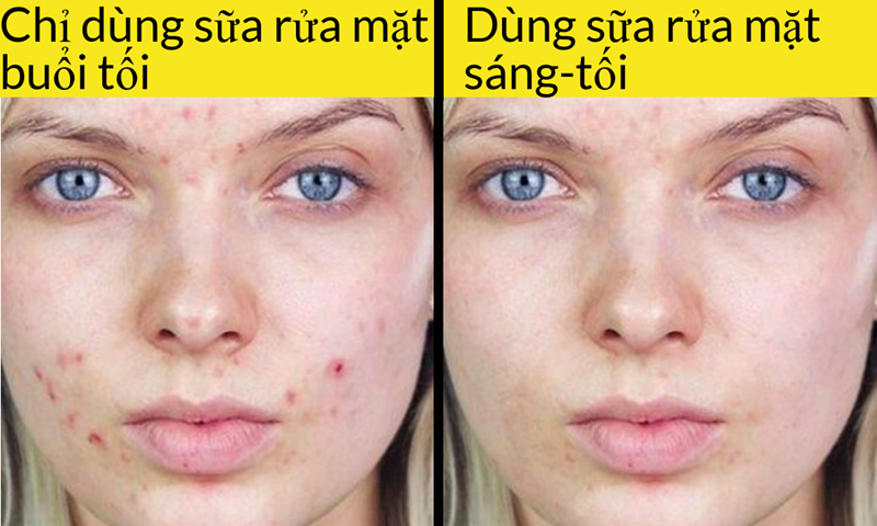 Chỉ dùng sữa rửa mặt buổi tối: Nhiều người chỉ dùng gel và sữa rửa mặt vào buổi tối để rửa lớp trang điểm ban ngày, còn bước rửa mặt buổi sáng lại không. Bạn không hề biết rằng, mình cần phải loại bỏ bã nhờn, các tế bào da chết, bụi bẩn và mồ hôi trên da sau một đêm dài.