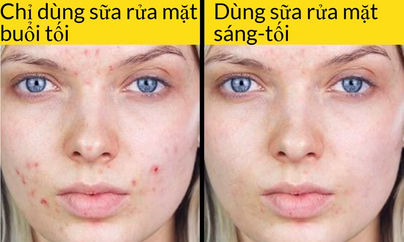 Chỉ dùng sữa rửa mặt buổi tối: Nhiều người chỉ dùng gel và sữa rửa mặt vào buổi tối để rửa lớp trang điểm ban ngày, còn bước rửa mặt buổi sáng lại không. Bạn không hề biết rằng, mình cần phải loại bỏ bã nhờn, các tế bào da chết, bụi bẩn và mồ hôi trên da sau một đêm dài.