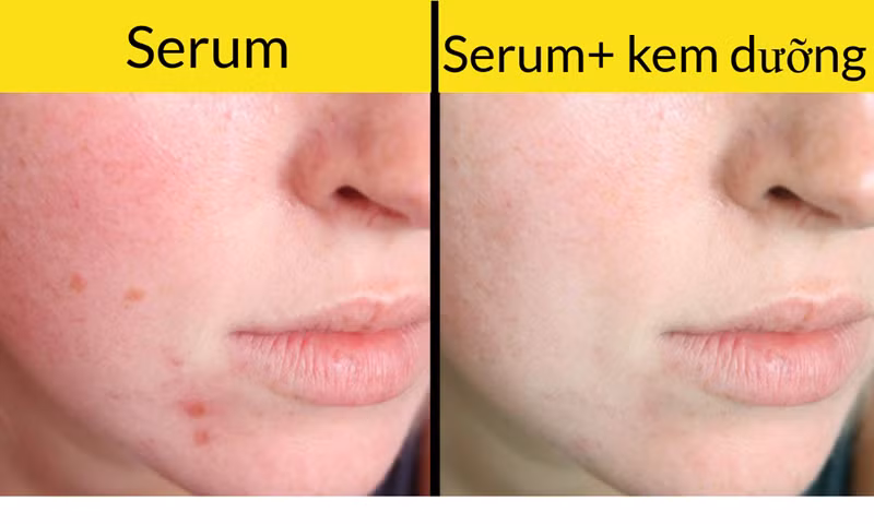 Serum (huyết thanh) nên được sử dụng trước khi bạn dùng kem dưỡng ẩm cho da. Và tốt hơn là nên dùng serum vào buổi tối, đặc biệt khi serum có chứa retinol. Điều này sẽ cho phép da hấp thụ đầy đủ các chất dinh dưỡng cần thiết. Vào mùa Hè, các sản phẩm giàu retinol sẽ làm cho da nhạy cảm với ánh nắng mặt trời và có thể gây ra cháy nắng, do vậy bạn nhất thiết phải sử dụng kem chống nắng.