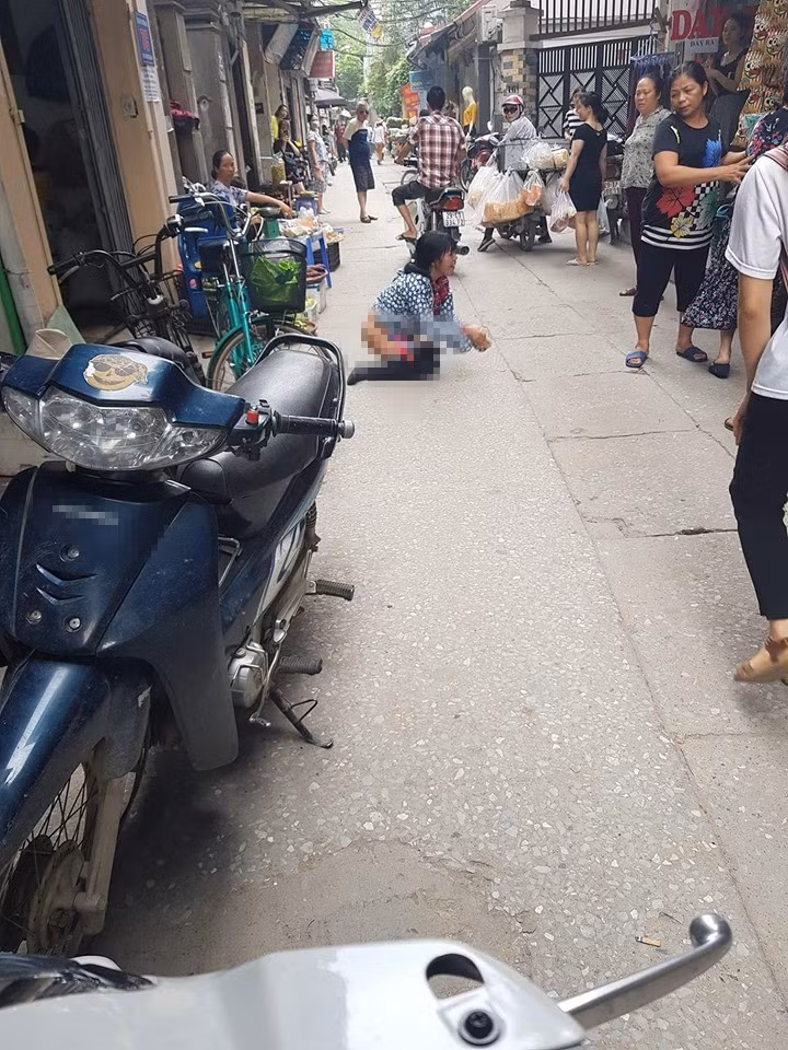 Bi bat vi an trom, nu quai hanh dong bat ngo gay phan no-Hinh-2