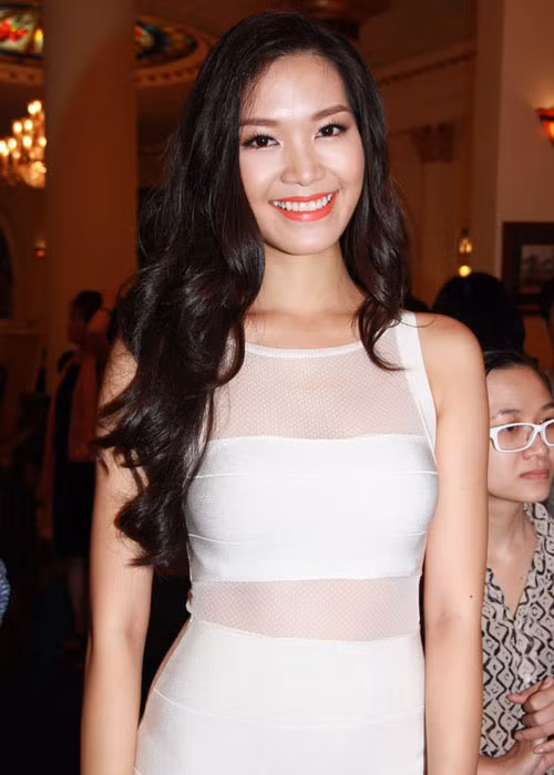 Thùy Dung đã đi niềng răng để có nụ cười rạng rỡ hơn. Ảnh: Danviet