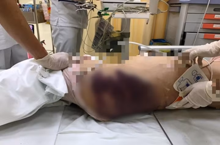 “Di ghe” bao hanh be 8 tuoi tu vong: Tu man danh dap den giet nguoi-Hinh-2