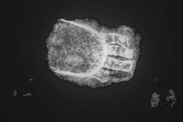 Bộ hài cốt Trung cổ này thuộc về một người đàn ông khoảng 30-50 tuổi, sống vào thế kỷ 15 và 17 (1450-1620).