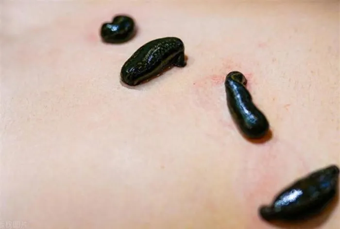 Mặc dù có vẻ ghê rợn, nhưng loại động vật được ví như " vàng mềm" này lại mang lại giá trị sinh học và y học cao.