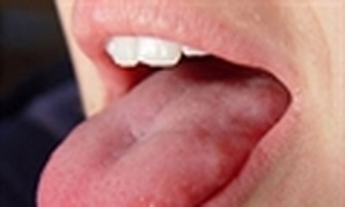 Su thuc xot xa chiec luoi dai “quai vat” cua cau be toi nghiep