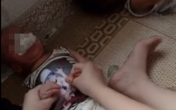 Tre mam non bi nhet gie o Thai Binh: Bo GD&DT yeu cau xu nghiem