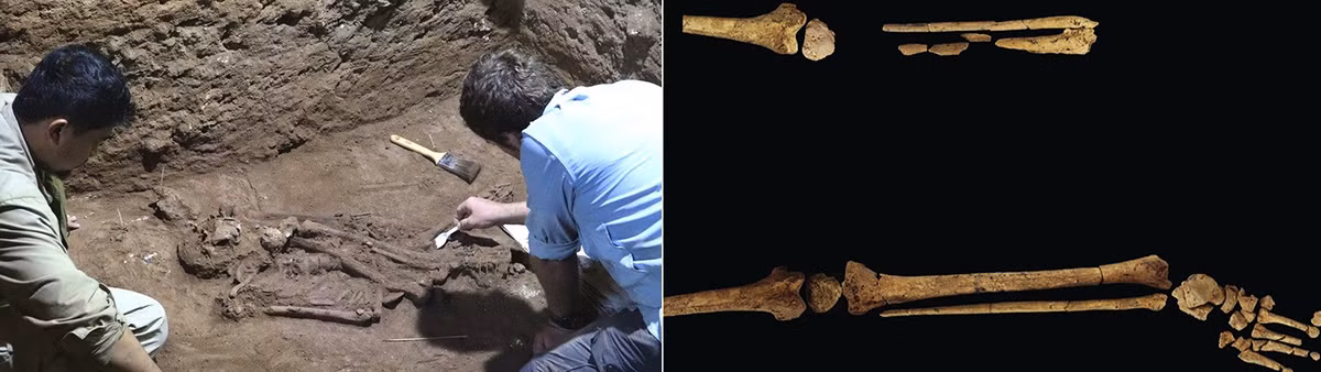 Theo suy đoán của các chuyên gia, bác sĩ đã phẫu thuật cắt cụt chân trái cho bệnh nhân khoảng 31.000 năm trước có thể đã dùng cao và các dụng cụ phẫu thuật làm từ đá. Họ dường như cũng có kiến thức chi tiết về giải phẫu và hệ thống cơ, mạch máu để tiến hành phẫu thuật thành công, đồng thời ngăn mất máu, gây nhiễm trùng và tử vong cho bệnh nhân.