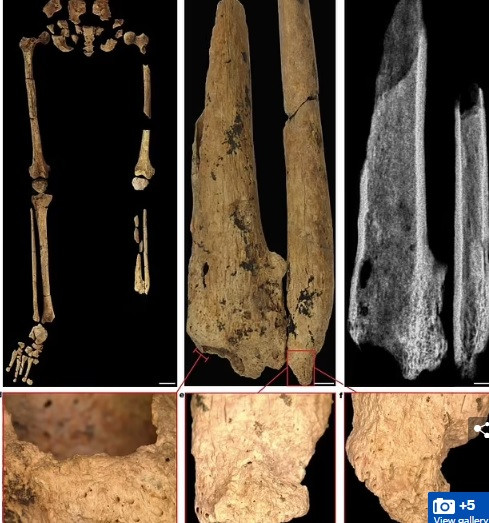 Cụ thể, nhóm nghiên cứu phát hiện hài cốt trên không bị xáo trộn trong suốt 31.000 năm. Dì vậy, họ hiện chưa thể xác định thi hài thuộc về nam giới hay phụ nữ.