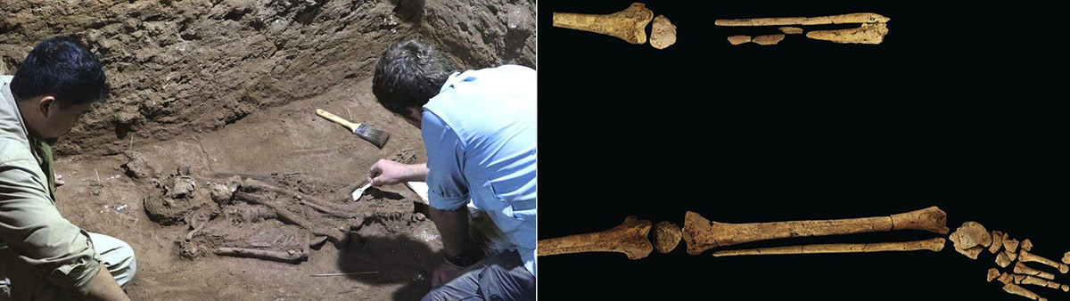 Theo suy đoán của các chuyên gia, bác sĩ đã phẫu thuật cắt cụt chân trái cho bệnh nhân khoảng 31.000 năm trước có thể đã dùng cao và các dụng cụ phẫu thuật làm từ đá. Họ dường như cũng có kiến thức chi tiết về giải phẫu và hệ thống cơ, mạch máu để tiến hành phẫu thuật thành công, đồng thời ngăn mất máu, gây nhiễm trùng và tử vong cho bệnh nhân.