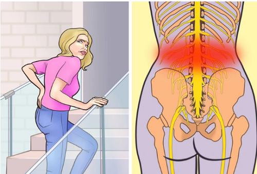 6. Thường xuyên đi cầu thang bộ. Đi cầu thang bộ là cách vận động lành mạnh. Vậy nhưng, nếu bị đau thắt lưng, đau đầu gối hoặc đau toàn bộ vùng lưng thì bạn nên tham khảo ý kiến bác sĩ trước khi theo đuổi bài tập này.