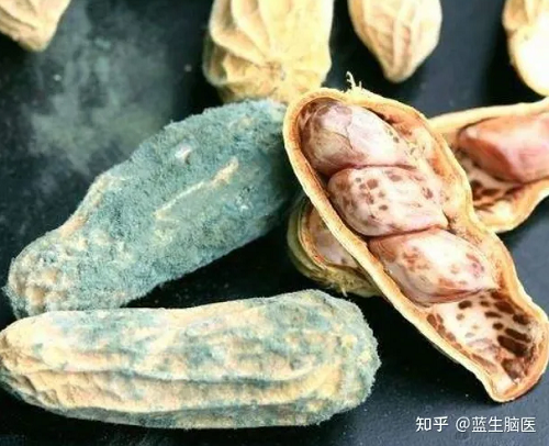 1. Thực phẩm chứa aflatoxin. Aflatoxin là chất gây ung thư mạnh nhất được phát hiện cho tới nay, đặc biệt là aflatoxin B1. Loại này độc gấp 68 lần asen, có thể gây ung thư ở nhiều cơ quan khác nhau.