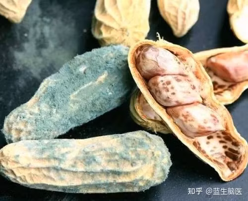 1. Thực phẩm chứa aflatoxin. Aflatoxin là chất gây ung thư mạnh nhất được phát hiện cho tới nay, đặc biệt là aflatoxin B1. Loại này độc gấp 68 lần asen, có thể gây ung thư ở nhiều cơ quan khác nhau.