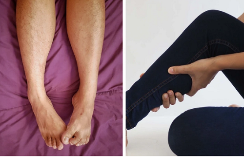 Co cơ ngẫu nhiên. Có nhiều nguyên nhân gây co cơ như hoạt động thể chất, căng thẳng, mất nước hoặc ngủ không đủ giấc. Đặc biệt, đây cũng có thể là dấu hiệu rối loạn thần kinh hoặc bệnh thận.