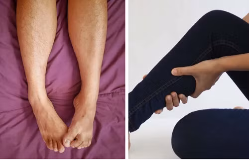 Co cơ ngẫu nhiên. Có nhiều nguyên nhân gây co cơ như hoạt động thể chất, căng thẳng, mất nước hoặc ngủ không đủ giấc. Đặc biệt, đây cũng có thể là dấu hiệu rối loạn thần kinh hoặc bệnh thận.