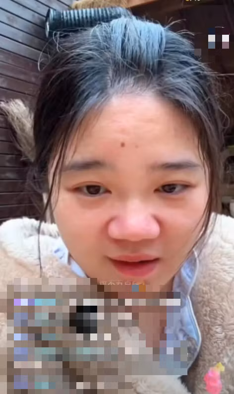 Làn da kém mịn màng, gương mặt tròn hơn, mũi nở to, diện mạo khác hẳn thời hoàng kim.(Ảnh: News.QQ)