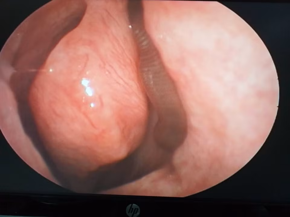 Lien tuc chay mau mui, nguoi dan ong di kham phat hien di vat khung khiep