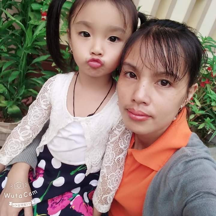 Xot xa hoan canh be gai 5 tuoi bi bong nang-Hinh-2