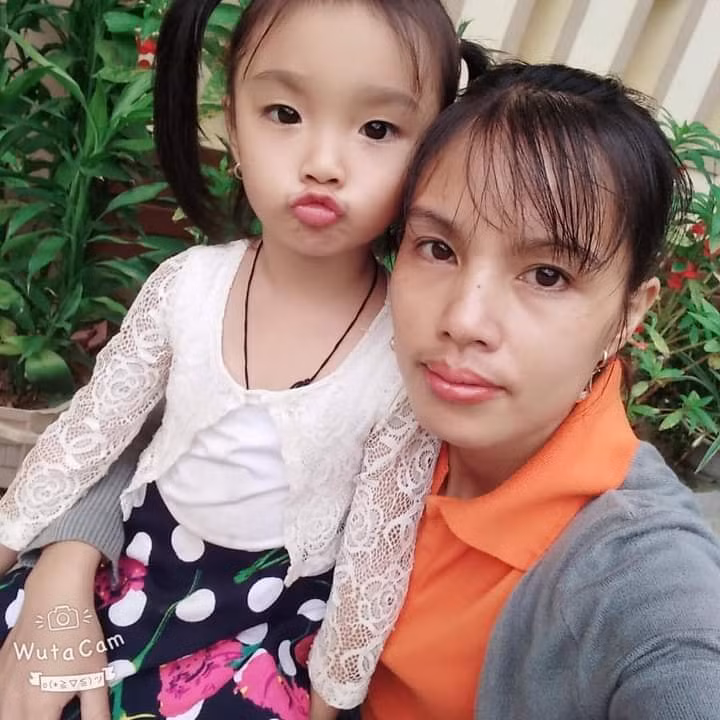 Xot xa hoan canh be gai 5 tuoi bi bong nang-Hinh-2