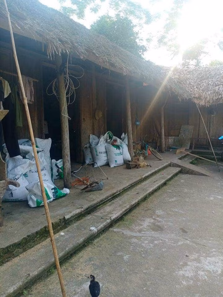 Xot xa hoan canh be gai 5 tuoi bi bong nang-Hinh-3