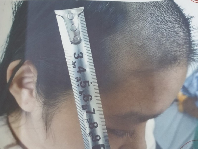  Cha nghiện ma túy, bạo hành dã man con gái 15 tuổi: Mỗi lần sử dụng xong ma túy Nguyễn Anh Đức (41 tuổi, Bắc Ninh) lại dùng roi và tông đơ để đánh đập, cắt tóc, bạo hành con gái 15 tuổi. Cuối tháng 12/2020, Đức tiếp tục bạo hành con gái. Nhờ sự giúp đỡ của họ hàng, cháu H. mới được đưa đến nhà người thân, sau đó đưa đến bệnh viện đa khoa tỉnh Bắc Ninh chữa trị. Tháng 1/2021, Đức bị bắt khẩn cấp. 