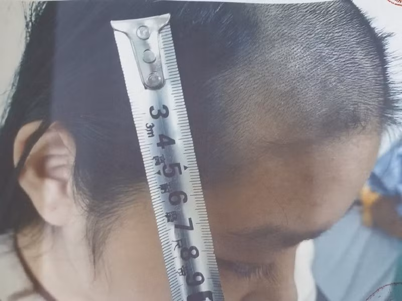  Cha nghiện ma túy, bạo hành dã man con gái 15 tuổi: Mỗi lần sử dụng xong ma túy Nguyễn Anh Đức (41 tuổi, Bắc Ninh) lại dùng roi và tông đơ để đánh đập, cắt tóc, bạo hành con gái 15 tuổi. Cuối tháng 12/2020, Đức tiếp tục bạo hành con gái. Nhờ sự giúp đỡ của họ hàng, cháu H. mới được đưa đến nhà người thân, sau đó đưa đến bệnh viện đa khoa tỉnh Bắc Ninh chữa trị. Tháng 1/2021, Đức bị bắt khẩn cấp. 