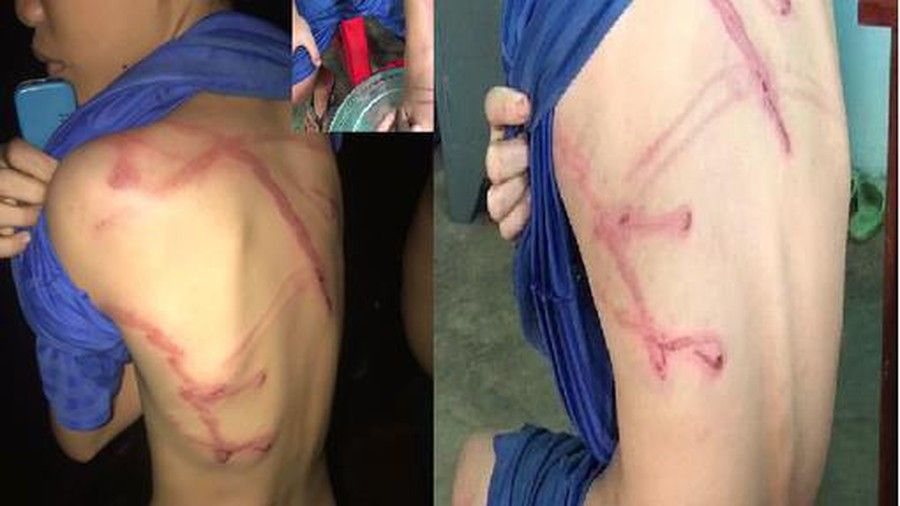  Con trộm tiền, thẻ điện thoại bị bố dùng dây điện đánh: Phát hiện con (bé N.T.P. 12 tuổi) ăn cắp tiền, thẻ cào điện thoại nạp tiền chơi game, lười biếng, không phụ giúp việc nhà, ông Nguyễn Văn Lành (37 tuổi, quê An Giang) dùng dây điện đánh con. Tháng 6/2020, Công an xã Long Hà đã xử phạt hành chính ông Lành về hành vi của mình. 