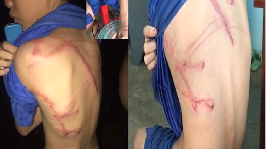  Con trộm tiền, thẻ điện thoại bị bố dùng dây điện đánh: Phát hiện con (bé N.T.P. 12 tuổi) ăn cắp tiền, thẻ cào điện thoại nạp tiền chơi game, lười biếng, không phụ giúp việc nhà, ông Nguyễn Văn Lành (37 tuổi, quê An Giang) dùng dây điện đánh con. Tháng 6/2020, Công an xã Long Hà đã xử phạt hành chính ông Lành về hành vi của mình. 