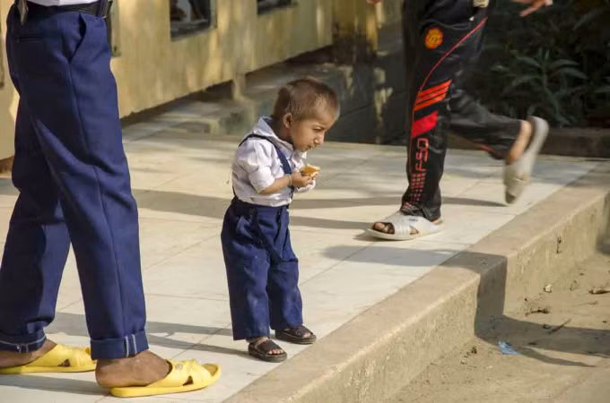 Chuyen chua ke ve cau be ti hon-Hinh-2