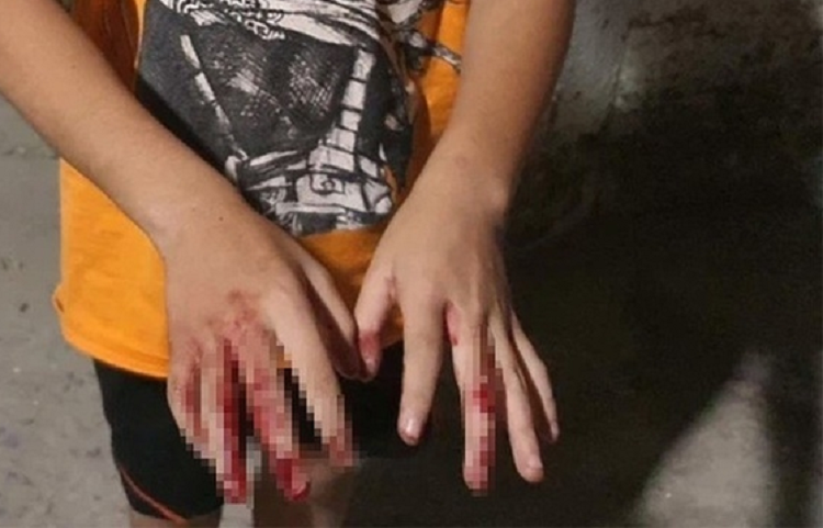 Thong tin trai nguoc vu be trai bi cha danh dap tay o TP.HCM