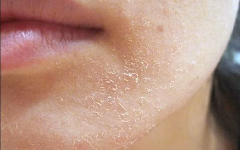 4 dau hieu cho thay ban dang lao hoa cuc nhanh-Hinh-4