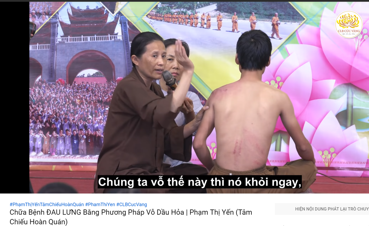 Bac si noi gi ve phuong phap vo dau hoa chua benh cua co Yen chua Ba Vang?-Hinh-2
