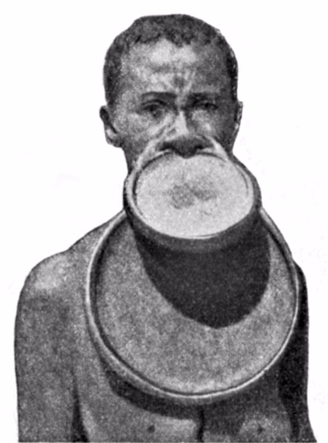 Thêm nữa, những cô gái có chiếc đĩa căng môi được cho là thu hút người khác giới hơn và rất có ích trong việc nhận của hồi môn từ nhà chồng.