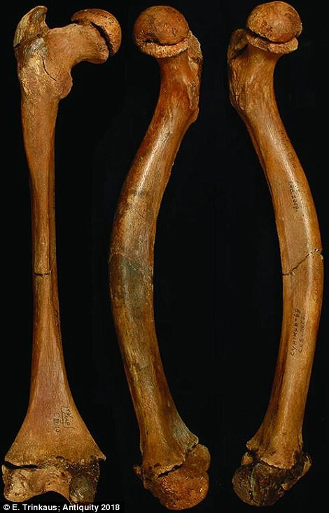 Theo các chuyên gia, đứa bé 12 tuổi có thể chịu nhiều đau đớn trước khi chết vì bệnh tật. Chuyên gia cũng cho rằng đứa bé có thể bị ốm nặng và chỉ được ăn thức ăn mềm. Phân tích xương cũng cho thấy bé trai này nằm liệt giường.