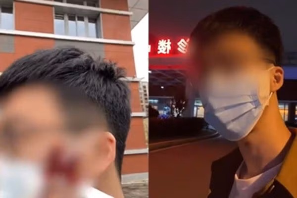 Tu nan mun, thanh nien suyt hong luon mat vi dieu nay-Hinh-2