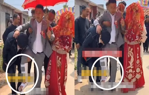 Bi ban treu qua da, chu re gay chan trong ngay cuoi