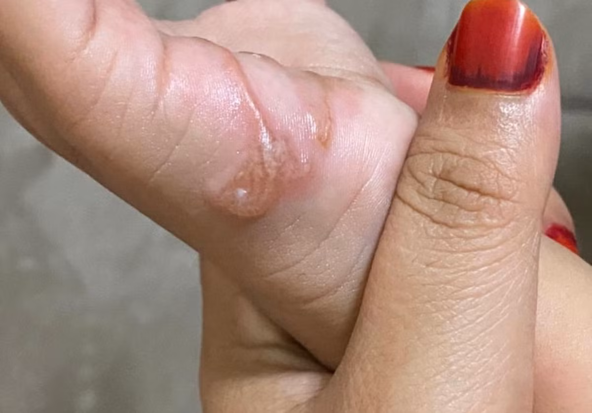 De con nghich cat, me phat hien dieu kinh di trong tay con-Hinh-2