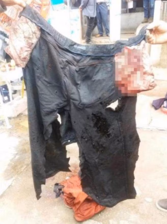 Hãi hùng lợn có sức mạnh ngang sư tử cắn chết người Hai hung lon co suc manh ngang su tu can chet nguoi