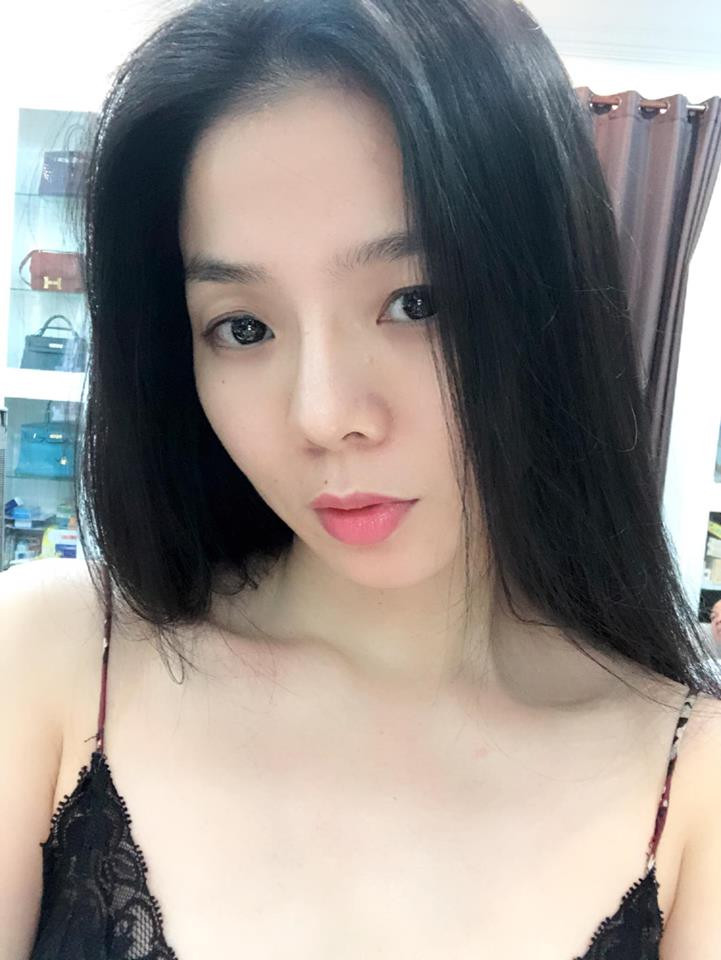 Theo Vietnamnet, người này cho biết thêm, ban đầu Lệ Quyên dự định qua liveshow của mình mới tiến hành tiểu phẫu nhưng bác sĩ không đồng ý vì nếu để lâu sẽ gây nhiễm trùng, hoại tử, nguy hiểm tính mạng. Cách đây một tuần, nữ ca sĩ đã quyết định thực hiện tháo sụn mũi và may mắn mọi thứ đều diễn ra suôn sẻ.