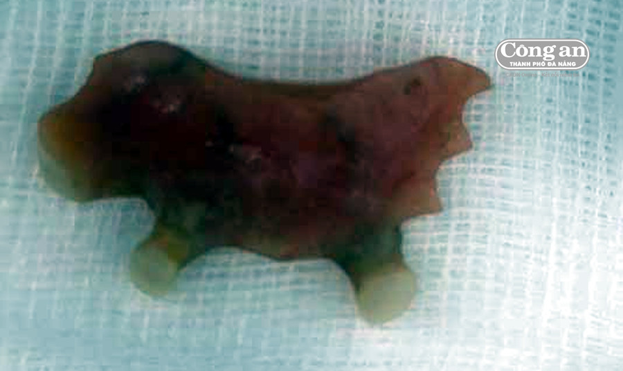 Rang gia “moc” trong... thuc quan