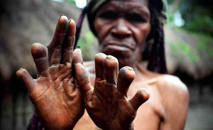 Rung ron noi mot nguoi than chet di, chat mot ngon tay